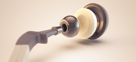 Model of Hip